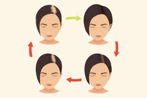 Get permanent hair with the FUE method