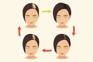 Get permanent hair with the FUE method