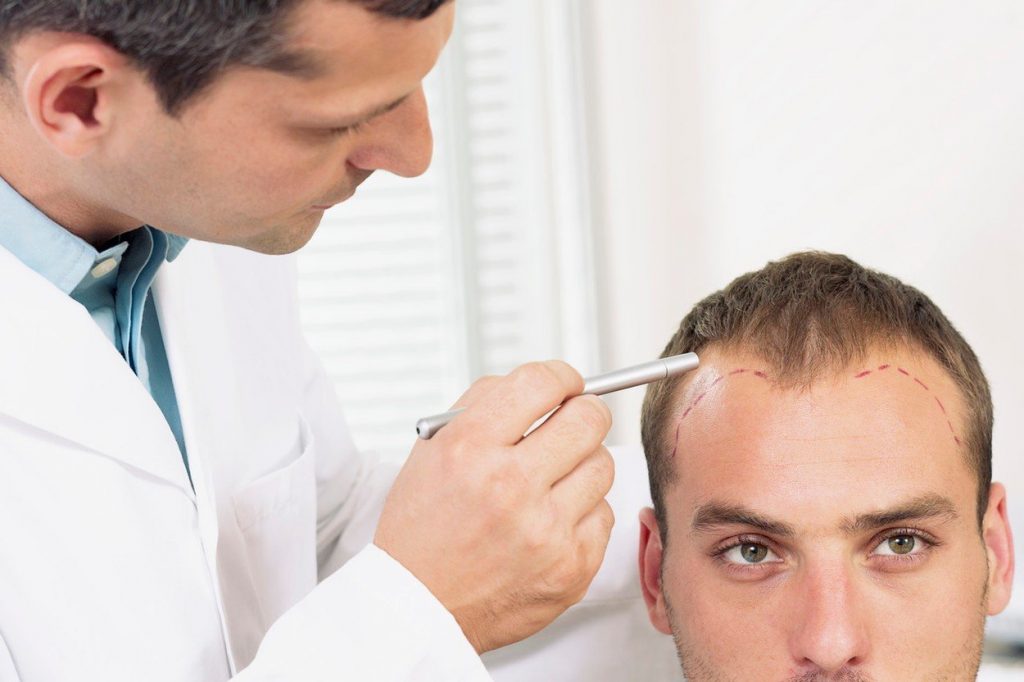 hair transplantation antalya turkey